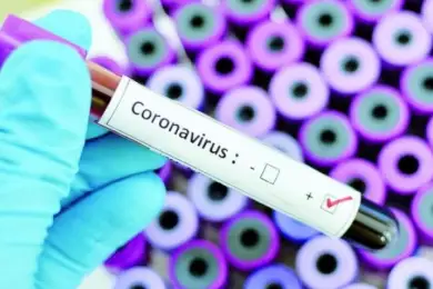 Ситуация с коронавирусом в Казахстан - онлайн-брифинг Минздрава РК 